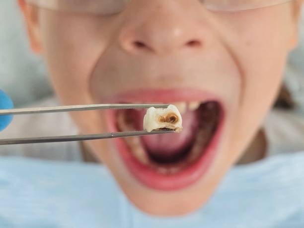 Best Orthodontic Emergency Dentist in Glenarden, MD